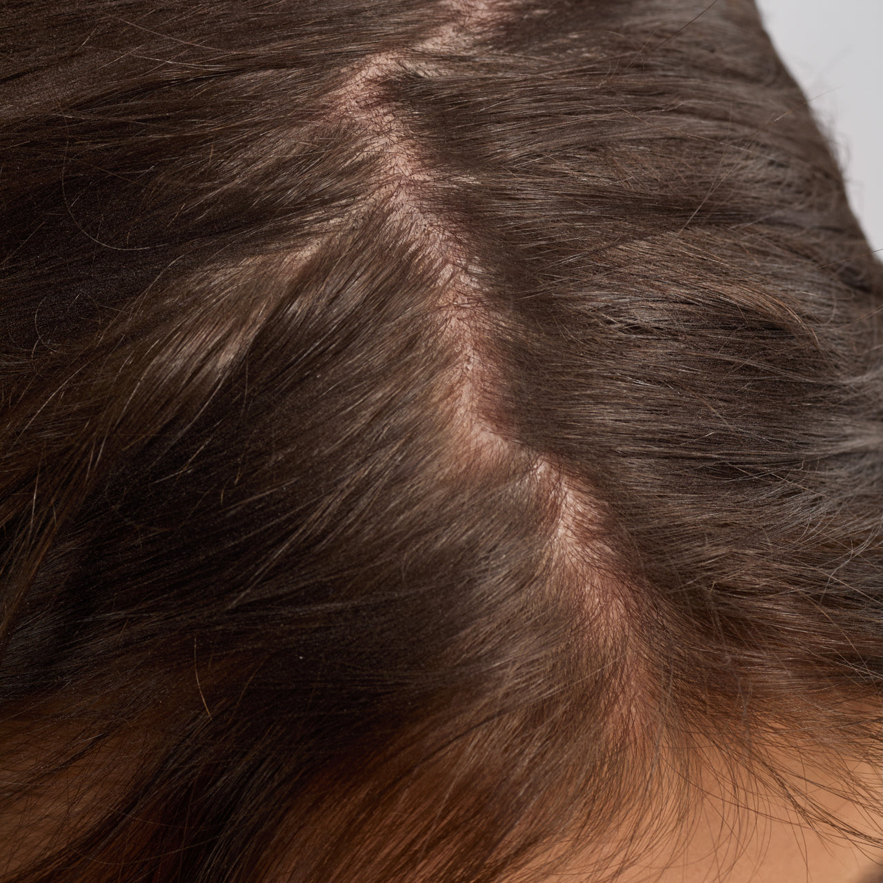 Rosmarin-Kopfhaut- und Haarstärkungsöl mit Biotin, 3er-Pack